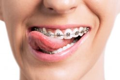 What Does An Orthodontist Do?