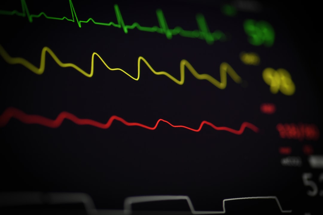 Close-up of a heart monitor display showing various colored heart rate lines